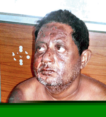 I have been trapped for blast case, says accused TMC Leader 