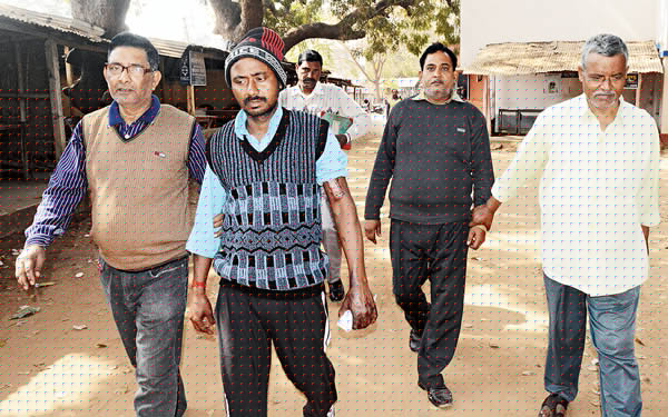 Two men arrested in woman burnt case at Sonamukhi