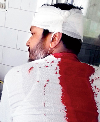 BJP leader Diptiman allegedly attacked by TMC