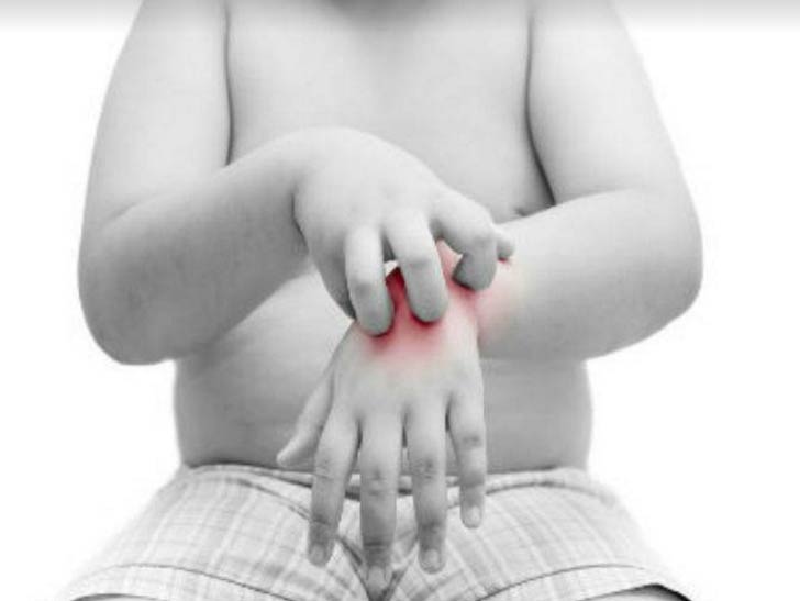 কার্বন ডাই-অক্সাইড: মশারা সমস্ত রকম কার্বন ডাই-অক্সাইডের প্রতি আকৃষ্ট হয়। পূর্ণবয়স্ক মানুষেরা <br>শিশুদের তুলনায় বেশি কার্বন ডাই-অক্সাইড ছাড়ে। ফলে শিশুদের তুলনায় তাদের মশা কামড়ায় বেশি। <br>ঠিক একই কারণে প্রসূতি মহিলাদের মশা বেশি কামড়ায়। কারণ তাঁরা বেশি Co2 ছাড়ে।