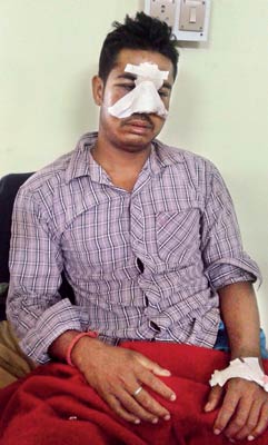 Jawaan beaten heavily by Miscreants 
