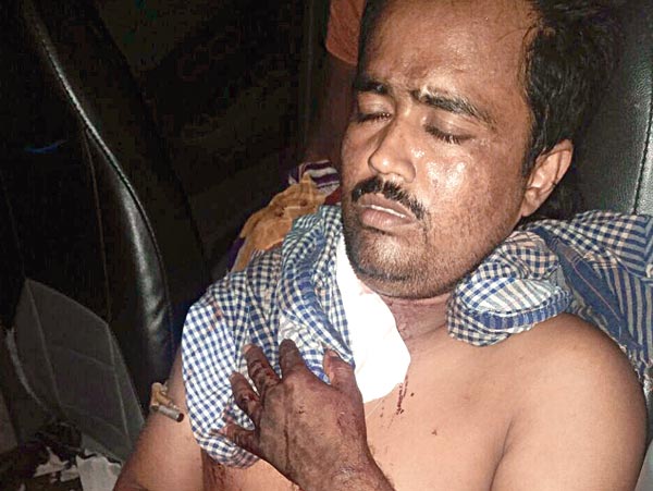 Miscreants shoot a TMC leader 