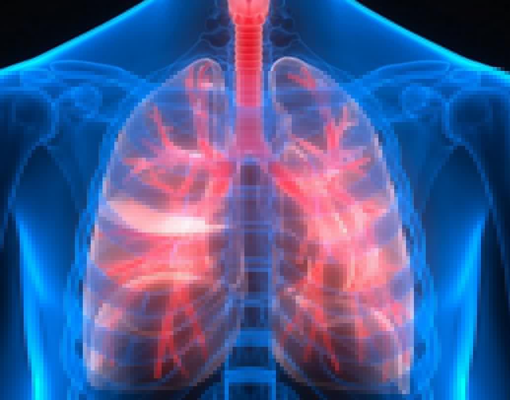 চামচে সাদা দাগ শ্বাসযন্ত্রের কোনও সংক্রমণের ফল হতে পারে।