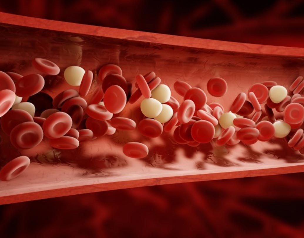 বেগুনি রঙের দাগ হলে রক্ত চলাচলের সমস্যা দেখা দিতে পারে। রক্তে কোলেস্টেরলের মাত্রা খুব বেশি বেড়ে গেলে বা রক্তে অক্সিজেনের পরিমাণ কমে গেলে এরকম হয়ে থাকে।