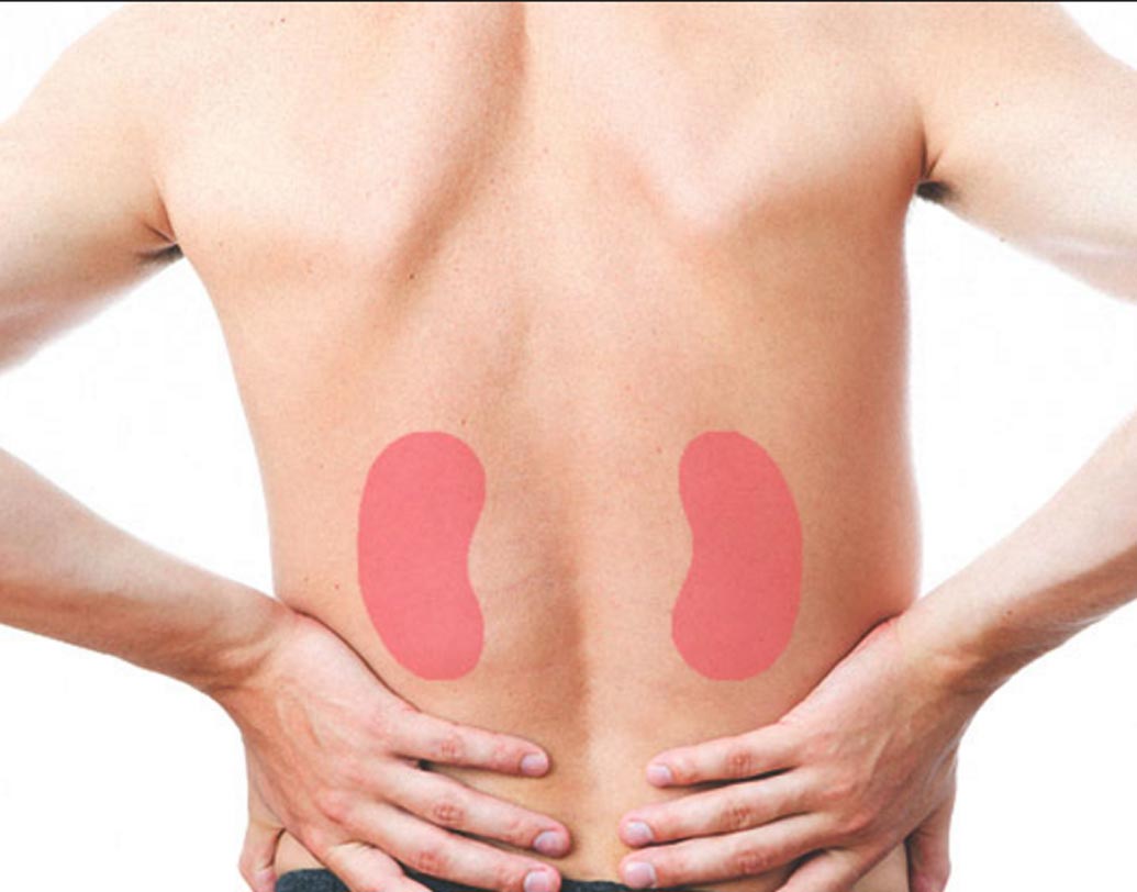 এবং দাগ যদি কমলা রং ধারণ করে তাহলে কিডনির সমস্যায় ভুগতে পারেন। কারণ কিডনির সমস্যা দেখা দিলে রক্তে ক্যারোটিন-সদৃশ উপাদান জমা হতে থাকে। এর ফলেই কমলা রঙের দাগ হয়।