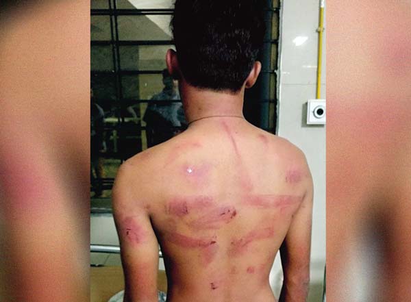 Polytechnic student brutally beaten by juniors at Suri