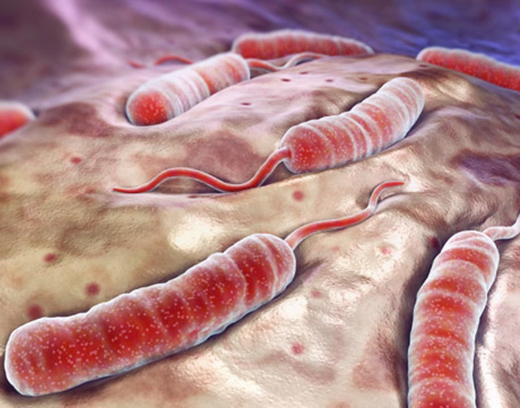 কলেরা: পরিচ্ছন্নতার অভাব ও দুর্বল হাইজিনের কারণে খাবার, জল সংক্রমিত হলে দ্রুত হারে ছড়িয়ে পড়ে কলেরা। কলেরা ভয়াবহ আকার ধারণে করলে তা প্রাণঘাতীও হতে পারে।