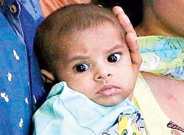 Each child has the right to get the most advanced treatment