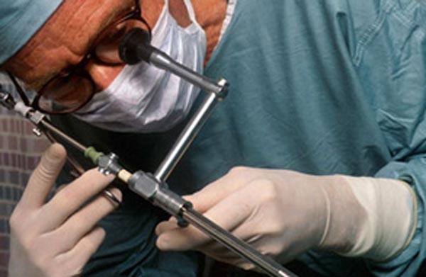 Cancer surgery in Laparoscopic system