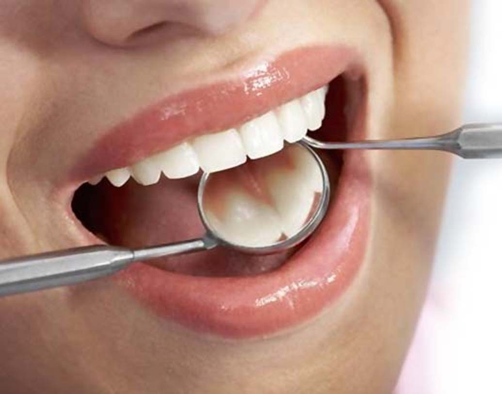 মাড়ি থেকে রক্তপাত: মাড়ি থেকে রক্তপাত মোটেও ভাল লক্ষণ নয়। আপনার শরীরে ভিটামিন সি-র অভাব হলে এমনটা হতে পারে। লেবু জাতীয় ফল, পালং শাক, সবুজ সব্জি, টোম্যাটো, বাঁধাকপি, ফুলকপি, ব্রকোলি খাওয়া প্রয়োজন খেতে হবে বেশি করে।