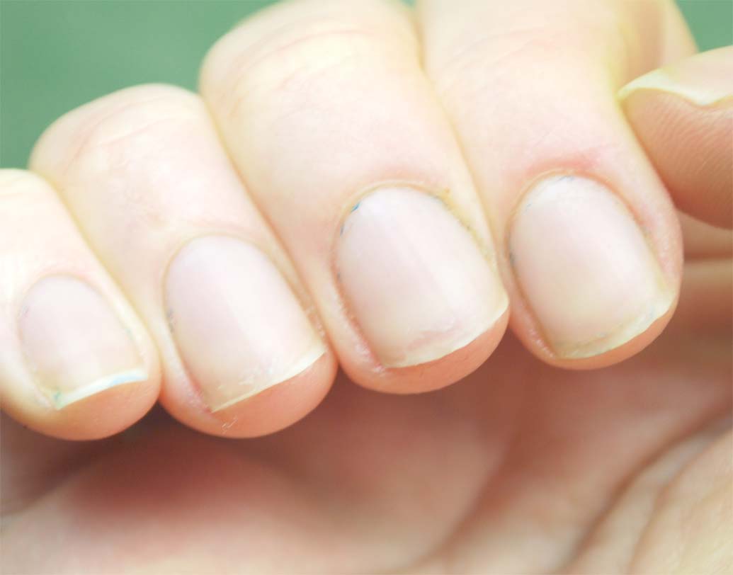 নখ ও চুল: নখ, চুলের ডগা ভেঙে যাওয়া শরীরে বি ভিটামিনের অভাবের লক্ষণ। এমনটা হলে দুধ, মাশরুম জাতীয় খাবার খান।