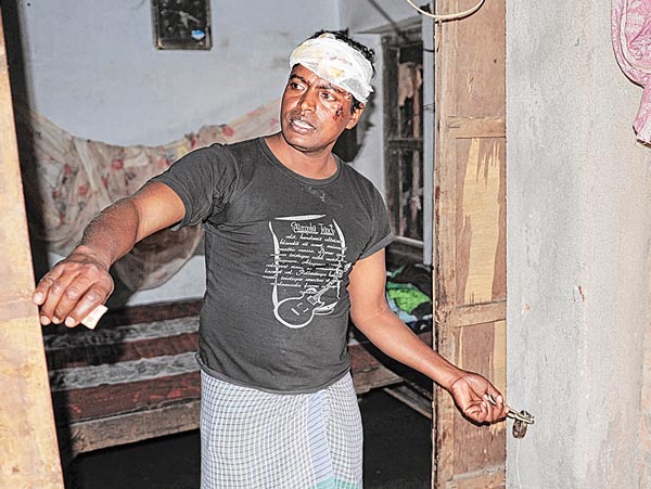 Two brothers got beaten badly by the miscreants