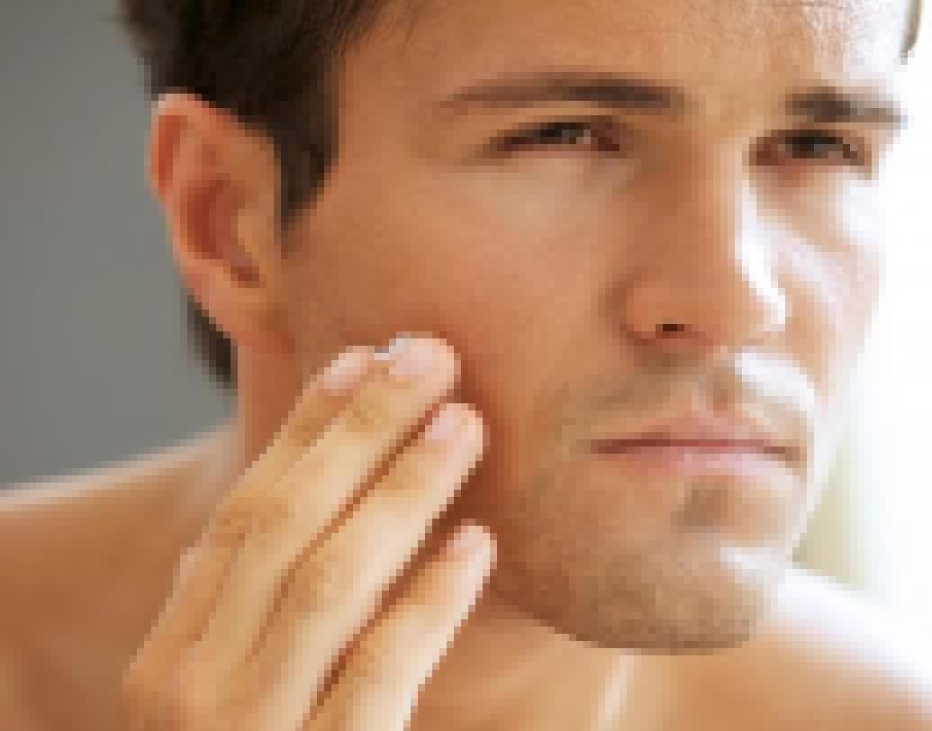 অতিরিক্ত স্ট্রেসের ফলে ত্বক শুষ্কও হয়ে যেতে পারে। কর্টিসল হরমোন ত্বককে হিহাইড্রেটেড করে দেয়। ফলে ত্বক অতিরিক্ত শুষ্ক ও অনুজ্জ্বল দেখায়।