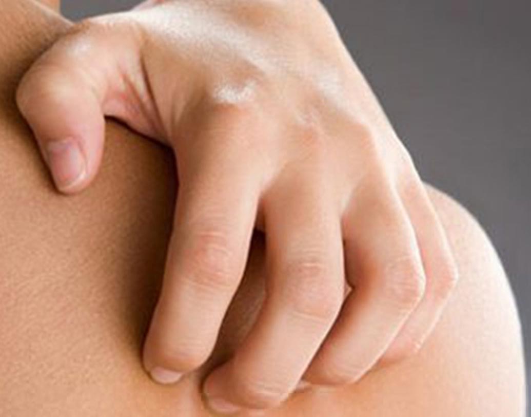 অতিরিক্ত স্ট্রেস হলে ত্বকের বিভিন্ন গ্রন্থি উত্তেজিত হয়ে ওঠে। যার ফলে বিভিন্ন রাসায়নিকের ক্ষরণ হয় ও ত্বকে চুলকানি, প্রদাহ হয়।