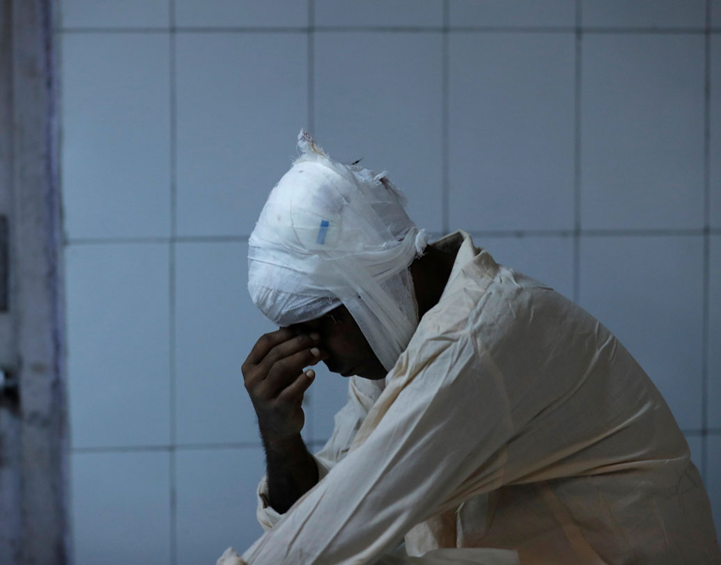 সবার নজর ছিল হয় জলন্ত রাবণের দিকে, নয়তো মোবাইলের স্ক্রিনে। তাই আচমকা ট্রেন চলে আসায় কিংকর্তব্যবিমূঢ় হয়ে পড়েন সকলে। কিছু বুঝে ওঠার আগেই পিষে দিয়ে চলে যায় ট্রেন।