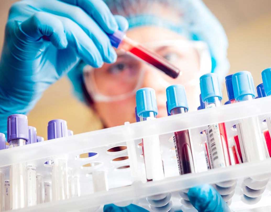 মহিলা কোন দেশের তা নিশ্চিত করার জন্য শুরু হয়েছে কঙ্কালের বিশেষ ডিএনএ পরীক্ষা। করা হবে স্টেবল আইসোটোপ অ্যানালিসিসও। যদিও রোমের বাসিন্দা যে এই মহিলা তা মোটামুটি নিশ্চিত করেছেন গবেষকরা।