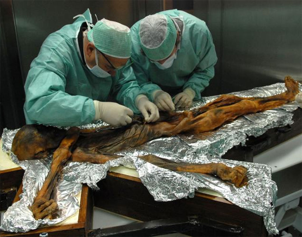 সম্প্রতি ৫৩০০ বছর আগের এই মানুষটি মৃত্যুর আগে শেষবারের মতো যে খাবার খেয়েছিলেন তার হদিশ পেয়েছেন বিশেষজ্ঞরা। সুষম হলেও খাবারে উচ্চমাত্রায় ফ্যাট ছিল বলেও জানান তারা।