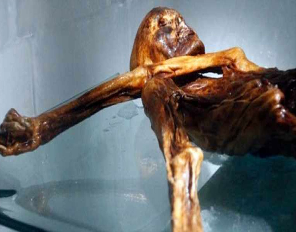 তাঁর ত্বকের প্রতিটি ভাঁজ পর্যন্ত নথিভুক্ত করা হয়। কিন্তু সমস্যা হয়েছিল অন্য জায়গায়।পাওয়া যাচ্ছিল না পাকস্থলী। পরে সেই পাকস্থলীর অবস্থান নির্ণয় করেন বিজ্ঞানীরা।