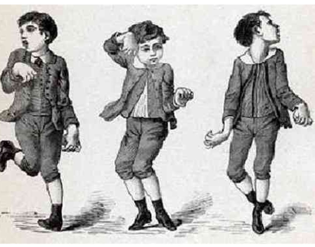 এটিই ইউরোপে ছড়িয়ে পড়া প্রথম এবং একমাত্র নাচের মহামারী নয়। ১৫১৮ সালের পূর্বে ‍ইউরোপের বিভিন্ন স্থানে কমপক্ষে ১০ বার এ মহামারীর দেখা পাওয়া গিয়েছিল।১৩৭৪ সালের দিকে এ মহামারী দেখা গিয়েছিল বর্তমান বেলজিয়াম অঞ্চলে, উত্তর-পূর্ব ফ্রান্সে এবং লুক্সেমবার্গে।