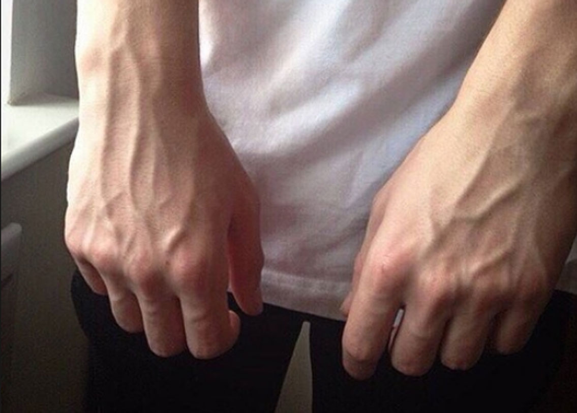 যাঁদের শরীরে মেদের পরিমাণ খুব কম অর্থাৎ যাঁরা রোগা হয়, তাঁদেরও ত্বক পাতলা হয়ে থাকে। ফলে বাইরে থেকে শিরাগুলো খুব স্পষ্ট হয়ে ওঠে।