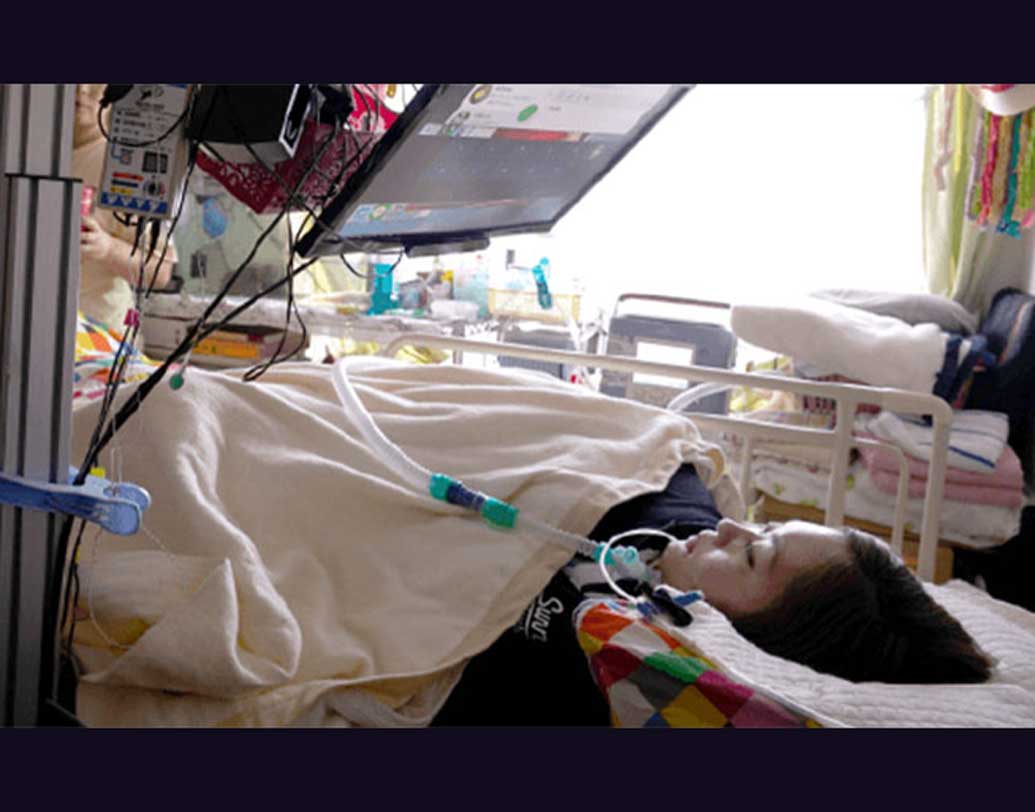 অ্যামিওট্রফিক ল্যাটারাল স্ক্লেরোসিস বা এ জাতীয় শিরদাঁড়ার সমস্যায় যাঁরা শয্যাশায়ী, তাঁরাই রোবটগুলিকে চালনা করেন। বেশিরভাগ রোগীই কিন্তু পক্ষাঘাতগ্রস্ত।