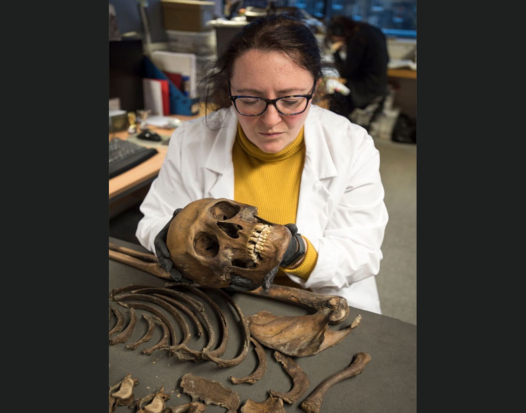 বিশেষজ্ঞরা জানিয়েছেন, ওই ব্যক্তির সম্ভবত গাঁটে ব্যথা ছিল। শিরদাঁড়া ও বাঁ দিকের হিপ জয়েন্টে সমস্যা ছিল। বয়স সম্ভবত ৩৫ এর কাছাকাছি।