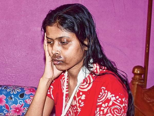 Attack on the young women