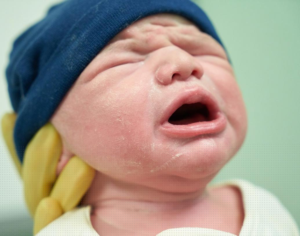 ৯ মাসে জলে ভাসমান অবস্থায় থাকার পর শিশুদের গায়ে প্রথম হাওয়া লাগে। যার ফলে ওদের ত্বক হঠাত্ শুকিয়ে যায়, চামড়া ওঠে। তাই ভয় পাবেন না। কিছু দিনের মধ্যেই সুন্দর গোলাপি হয়ে উঠবে আপনার শিশুর ত্বক।