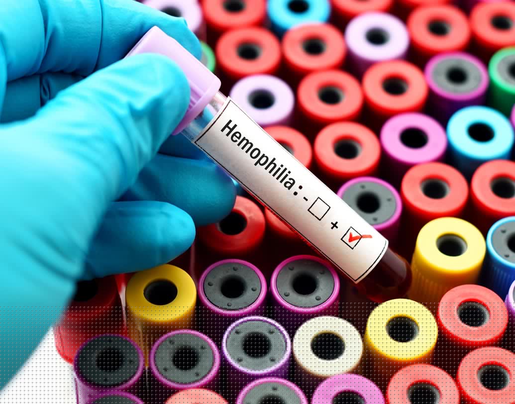 হিমোফিলিয়া সহ রক্তের জমাট বাঁধার সমস্যা হলে ক্রায়োপ্রেসিপিটেট দেওয়া দরকার।