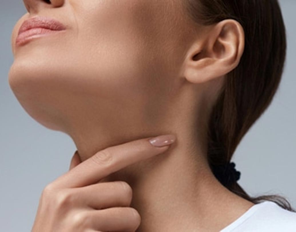 গালে বা গলায় কোনও ফোলা অংশ যা বাইরে থেকে বোঝা যাচ্ছে, কিন্তু কোনও ব্যথা বেদনা নেই বললেই চলে।