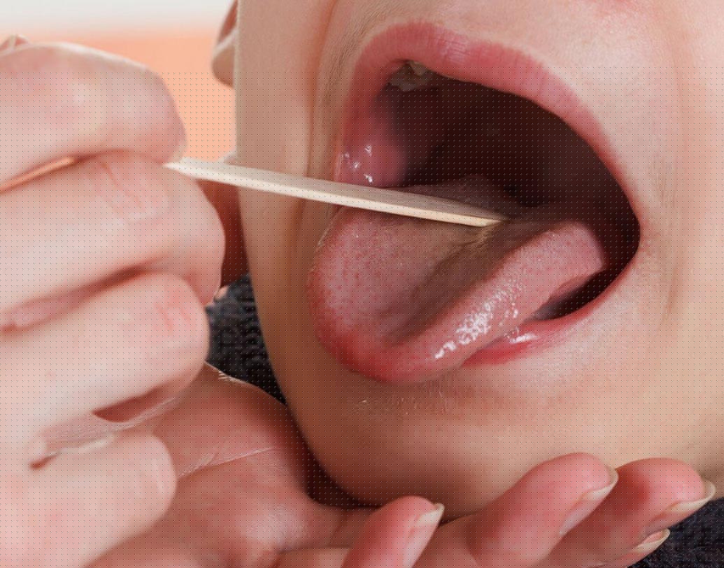 মুখের  ভেতরে কোনও ব্যথাহীন ফোলা অংশ আছে, যা ক্রমশ বাড়ছে।