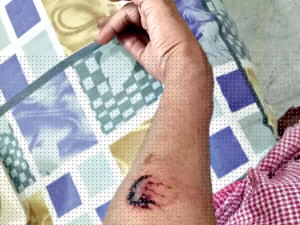 Cab driver bites a passenger in kolkata