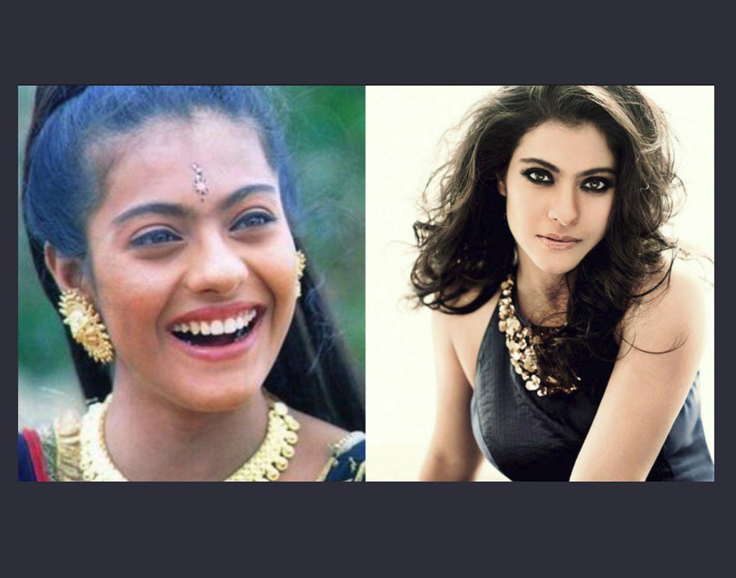 কাজল: মেলানিন সার্জারি করিয়ে বি-টাউনে সবচেয়ে বেশি সমালোচিত হয়েছেন যে নায়িকা তাঁর নাম কাজল। সুন্দরী হিসেবে তাঁর পরিচিতি ছিল গাঢ় রঙের জন্যই। ‘বাজিগর’ ছবির কথা মনে আছে? সেখানে নিজের রিয়েল লুকেই ধরা দিয়েছিলেন কাজল। কিন্তু ক্রমশ এই রঙের বদল হতে থাকে। বর্তমানে নিজের দুধে-আলতা রঙের রহস্য প্রকাশ্যে আনেননি নায়িকা। তবে মিডিয়ার দাবি, মেলানিন সার্জারি করিয়ে স্থায়ীভাবে ত্বকের রঙে বদল করিয়েছেন কাজল।