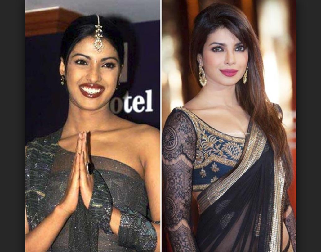 প্রিয়ঙ্কা চোপড়া: বিশ্ব সুন্দরীর খেতাব জেতা ‘মিস ওয়ার্ল্ড’ প্রিয়ঙ্কা আর বর্তমানের প্রিয়ঙ্কার মধ্যে বেশ অনেকটাই ফারাক। শোনা গিয়েছে, বারংবার সার্জারি করিয়ে গায়ের রং ফর্সা করিয়েছেন নায়িকা। তবে, শুধু রং নয়, তাঁর চেহারাতেও এসেছে অনেক বদল। রহস্যটা কী? মুখ খোলেননি নায়িকা।