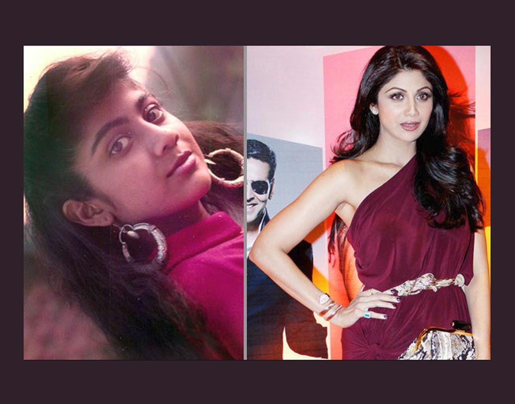 শিল্পা শেট্টি: লক্ষ্য করলেই দেখবেন কেরিয়ারের শুরুর দিকের শিল্পা এবং কুন্দ্রা ঘরণী শিল্পার মধ্যে আকাশ-পাতাল পার্থক্য। বি-টাউনে গুঞ্জন, সার্জারি করিয়ে তামাটে থেকে ফর্সা রঙের হয়েছেন এই বলি ডিভা। তবে নায়িকার দাবি, সার্জারি নয় এটা নিছকই নাকি ‘প্রেগন্যান্সি গ্লো।’