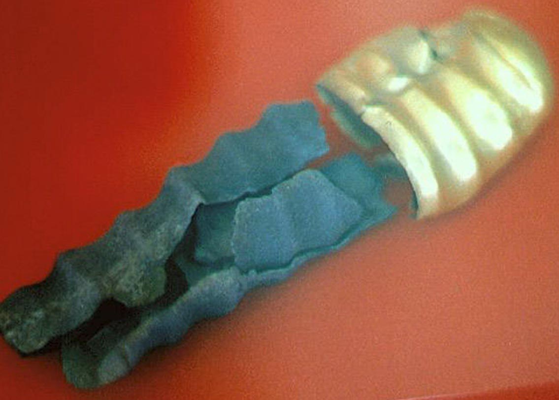 পঞ্চদশ শতকে গ্ল্যানস কন্ডোমের ব্যবহার শুরু হয়। ওই সময়ে এশিয়ার বিভিন্ন দেশে এর ব্যবহারের প্রমাণ মেলে। সাধারণত উচ্চ শ্রেণির মানুষদের মধ্যেই জন্ম নিয়ন্ত্রণের জন্য এই কন্ডোমের প্রচলন ছিল।