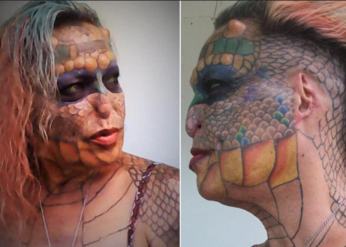 ২০১২ সালে তিনি নাক এবং কানের অস্ত্রোপচার করান। শরীরেও অনেকগুলো কসমেটিক সার্জারি করান। মুখে এবং শরীরে স্থায়ী ট্যাটু করান। যাতে দেখতে অনেকটা ড্রাগনের চামড়ার মতো লাগে। দাঁত তুলে ফেলেন। আর মাথায় ড্রাগনের শিংয়ের মতো ৮টি শিং বানান অস্ত্রোপচারের মাধ্যমে।