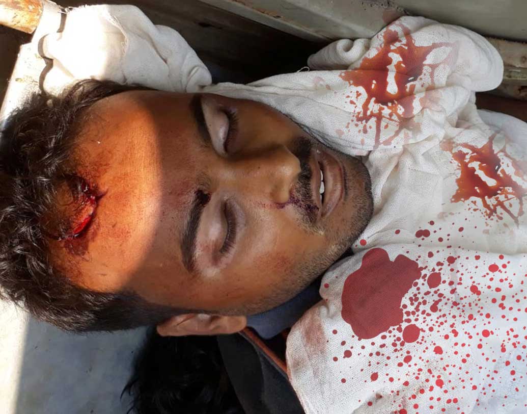 শান্তিপুরে ‘বুথ দখল’ করতে গিয়ে গণপিটুনির শিকার এই ছাত্র। সোমবার রাজ্যের বিভিন্ন জেলায় পঞ্চায়েত ভোটে সন্ত্রাসের বলি এ পর্যন্ত ১০ জন।