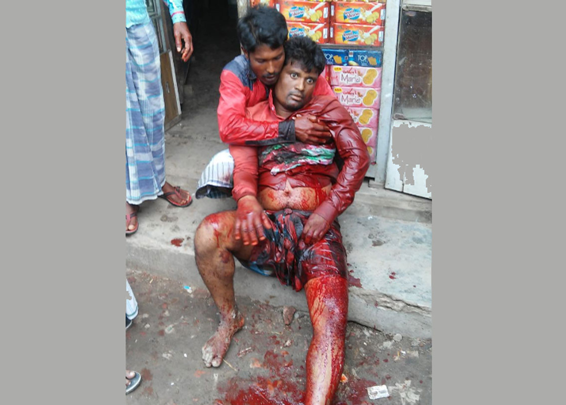 কুলতলিতে গুলিবিদ্ধ যুবক তখনও বেঁচে। রক্তে ভেসে যাচ্ছে চারপাশ। তবে ওই যুবক কোন দলের কর্মী তা এখনও জানা যায়নি।