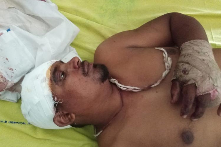 নন্দীগ্রামের সাতেঙ্গাবাড়ীতে আহত তৃণমূল এজেন্ট।