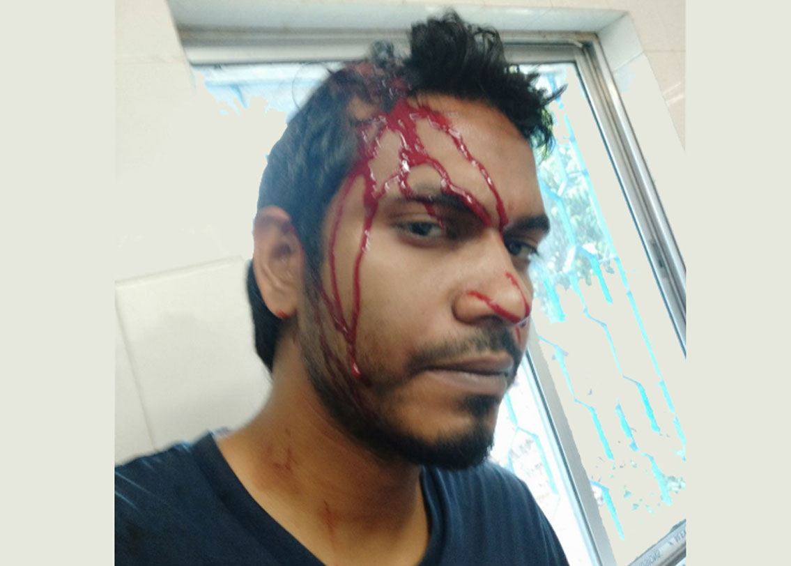 তমলুকের ধলহরা পশ্চিম বুথে নির্দল প্রার্থীর সমর্থক এক মহিলা সহ তিন জনকে মারধর করার অভিযোগ ওঠে। তমলুক জেলা হাসপাতালে তাঁদের ভর্তি করা হয়েছে। অভিযোগ ওঠে তৃণমূলের বিরুদ্ধে।