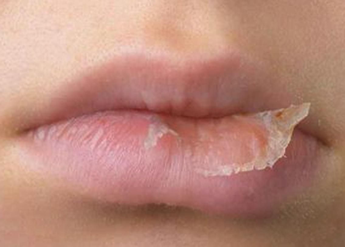 ঠোঁটের ত্বক খুবই পাতলা হওয়ায় দরুণ খুব দ্রুত তা শুষ্ক হয়ে ফেটে যায়। ঠোঁটকে ভাল রাখতে তাই প্রতিনিয়ত মরা কোষ দূর করা দরকার। আমরা কি তা আদৌ করি?