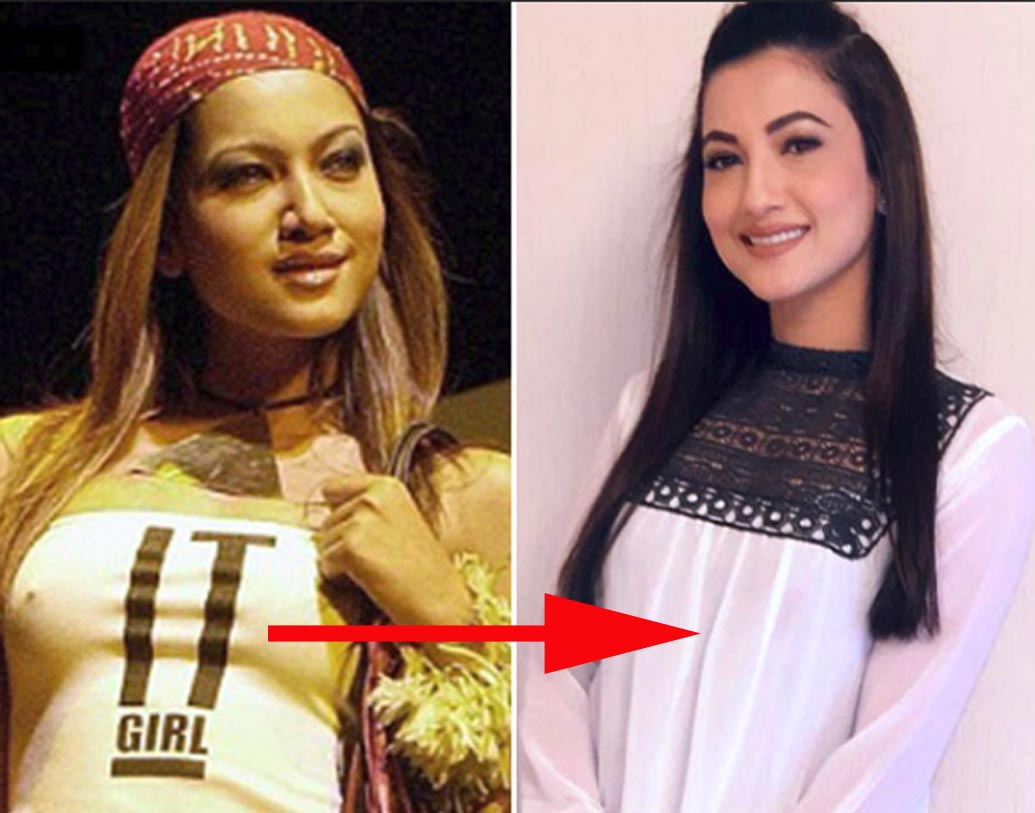 গহর খান: মডেলিং-এর দুনিয়ায় বেশ জনপ্রিয় মুখ গহর খান। পাশাপাশি, টিভি অ্যাঙ্করিং এবং বলি ফিল্মেও নাম করেছেন নায়িকা। ‘বিগ বস’ সিজন সাতে চ্যাম্পিয়ন হওয়ার পর তাঁর পরিচিতি আরও বাড়ে। নায়িকা জানিয়েছেন, ঠোঁট নিয়ে নাকি বরাবরই খুঁতখুঁতে ছিলেন তিনি। তাই নিজেকে ‘পারফেক্ট’ করে তুলতে লিপ সার্জারি করিয়েছেন।