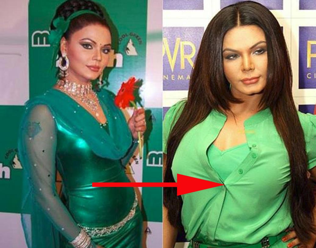 রাখি সবন্ত: বিতর্ক তৈরি করতে রাখি পটু। ইন্ডাস্ট্রির একটা অংশ তাঁকে চেনে ‘ড্রামা কুইন’ নামেই। নায়িকা জানিয়েছিলেন, মুখ এবং শরীরে নানা অংশের সার্জারি করিয়েছেন তিনি। সেই সঙ্গে রাখির মন্তব্য ছিল, বলিউডের বেশিরভাগ নায়িকাই নাকি প্লাস্টিক সার্জারি করিয়ে সুন্দর হয়েছেন। এই মন্তব্যের জন্য পরে বিতর্কে জড়িয়েছিলেন নায়িকা।