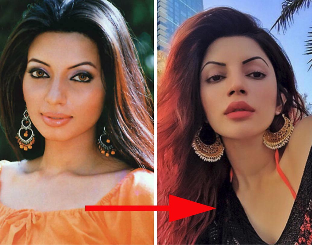 শামা সিকন্দর: ‘ইয়ে মেরি লাইফ হ্যয়’-এর পূজা মেহতাকে মনে আছে? যদিও পূজার ভূমিকায় তখনকার সেই শামা সিকন্দরকে দেখলে এখনকার সঙ্গে মেলাতে পারবেন না আপনি। প্লাস্টিক সার্জারির পর নিজের লুকে বিস্তর বদল এনেছেন নায়িকা।