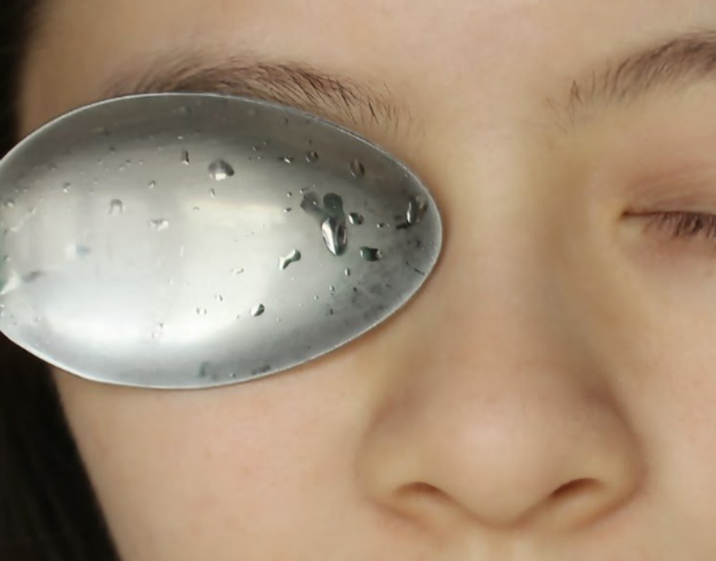 শশা বা আলু ঘরে নেই? কুছ পরোয়া নয়। ফ্রিজারে একটি চামচ রেখে দিন। এর পর চোখের ফোলা জায়গায় তা খানিক ক্ষণ রেখে দিন। দেখবেন ম্যাজিকের মতো কাজে আসবে এই টোটকা।