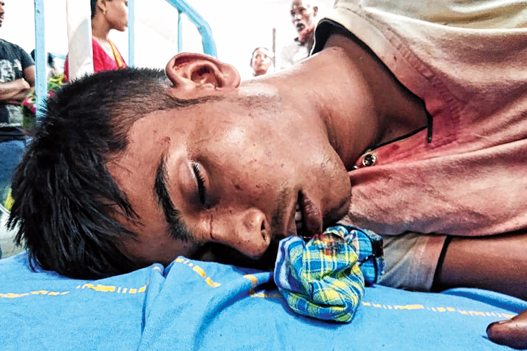 আক্রান্ত: চান্দামারিতে গুলিতে আহত নারায়ণ সরকার। কোচবিহার হাসপাতালে। ছবি: হিমাংশুরঞ্জন দেব