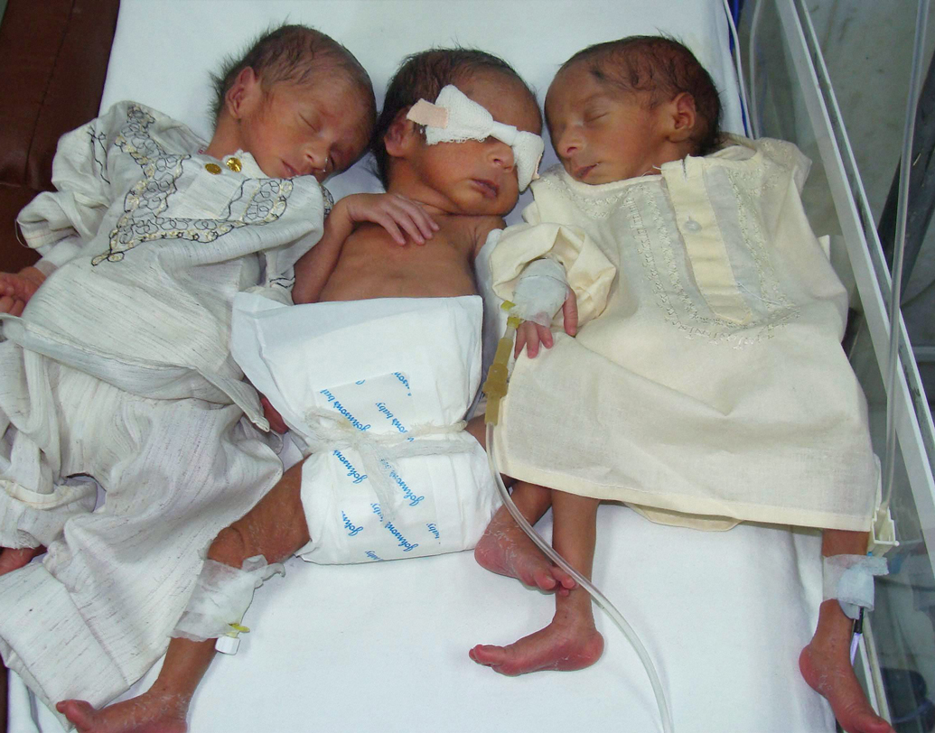 বর্তমানে এই পদ্ধতি আরও উন্নত হয়েছে। স্ত্রীরোগ বিশেষজ্ঞ মৌমিতা নাহা জানান, এখন সাধারণ আইভিএফ ছাড়াও ‘ইন্ট্রা সাইটোপ্লাজমিক স্পার্ম ইঞ্জেকশন’ (ICSI বা ইকসি), ‘এগ ডোনেশান’, ‘এমব্রায়ো ডোনেশান’-এর মাধ্যমেও গর্ভধারণ সম্ভব।