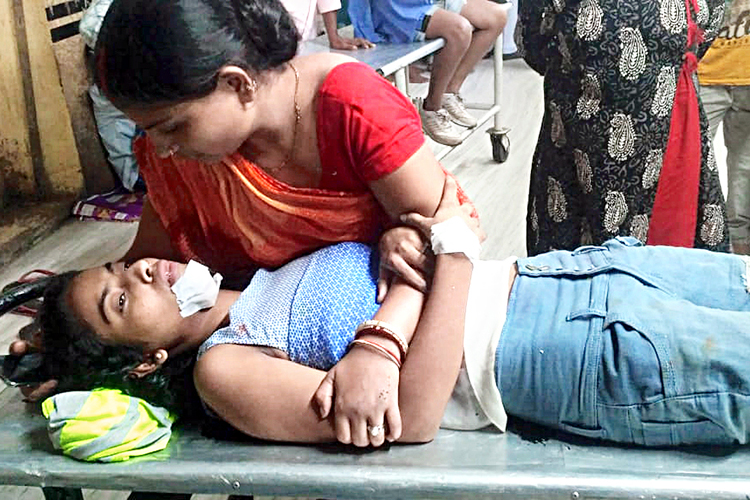 চিকিৎসাধীন: বাজ পড়ে আহত মনীষা মল্লিক। শনিবার এসএসকেএম হাসপাতালে। ছবি: দেবস্মিতা ভট্টাচার্য