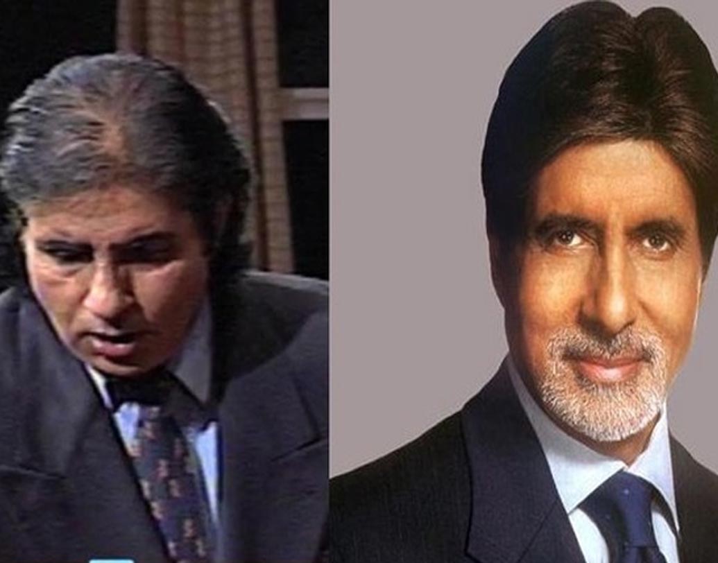 অমিতাভ বচ্চন: একটি টেলিভিশন শোয়ে বিগ বির মাথার ফাঁকা অংশ দেখা গিয়েছিল। যদিও এর কিছু দিনের মধ্যেই সেই ফাঁকা অংশ চুলে ঢাকা পড়ে যায়। ট্রান্সপ্ল্যান্ট করিয়েছিলেন তিনি, গুঞ্জন ছিল এমনটাই। কেউ বলেন, এখন নাকি তিনি পরচুলা ব্যবহার করেন।